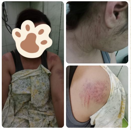 ASN Penghidup 3 Anak Dianiaya Wanita Lain di Jalan Raya! Leher & Tangan Penuh Memar, Usai Kejadian Suami Sah Terlihat Menunggu di RS